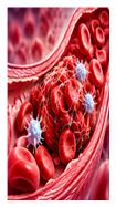 Respiratory Infections